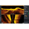 Трансдьюсер LOWRANCE Active Imaging 3-in-1